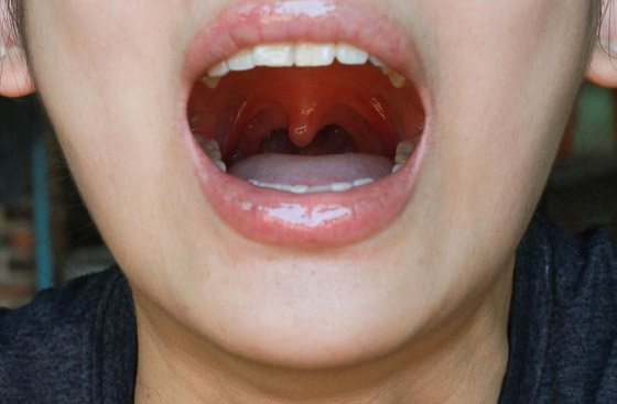 شعر الإبط والرموش.. أسباب امتلاك البشر لبعض الأجزاء العجيبة بالجسم صورة رقم 2