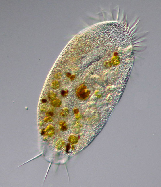 الأميبا آكلة الدماغ.. أكثر الطفيليات فتكا صورة رقم 6