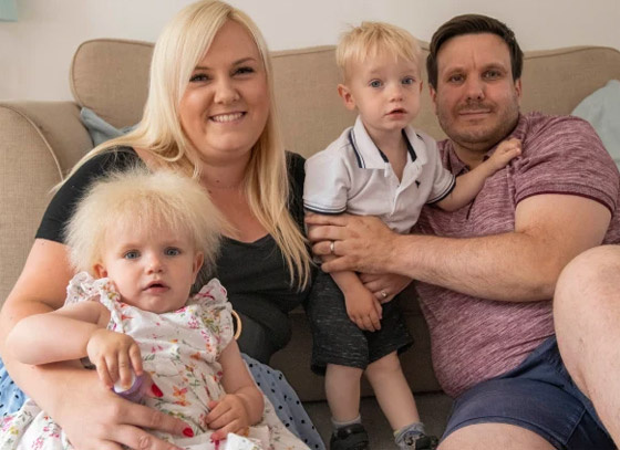 متلازمة نادرة.. رضيعة تثير الجدل بشدة شبهها لبوريس جونسون... شاهد صورة رقم 2