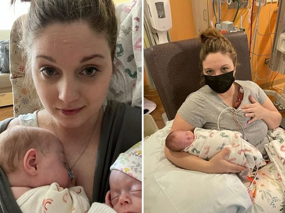 تنجب طفلتين توأم إحداهما أصغر بثلاث مرات من الأخرى صورة رقم 3