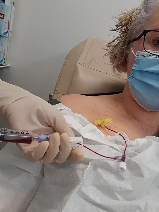  !تكتشف إصابتها بسرطان نادر بفضل تمرين رياضي صورة رقم 5