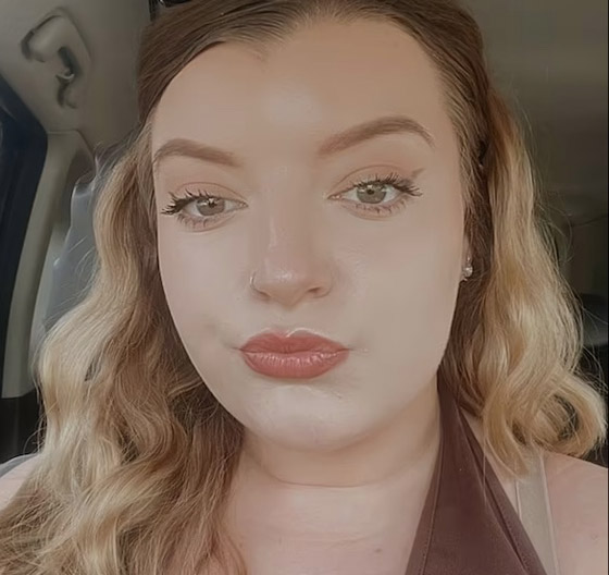 تنسى وضع الواقي الشمسي فيزداد حجم وجهها بمقدار الضعفين صورة رقم 3