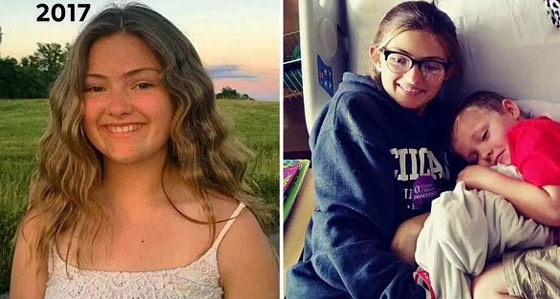 فتاتان تعانيان من تدهور جسدي ونفسي بسبب إنستغرام! صورة رقم 3