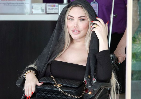 صور : تحول لنوع ثاننو90 عملية تجميل.. مليون إسترليني في سبيل 