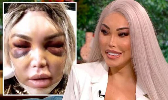 صور : تحول لنوع ثاننو90 عملية تجميل.. مليون إسترليني في سبيل 