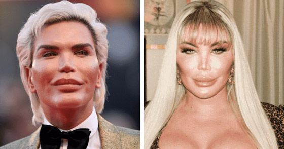 صور : تحول لنوع ثاننو90 عملية تجميل.. مليون إسترليني في سبيل 