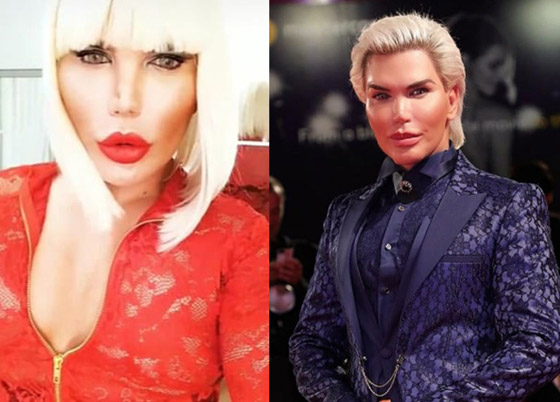 صور : تحول لنوع ثاننو90 عملية تجميل.. مليون إسترليني في سبيل 