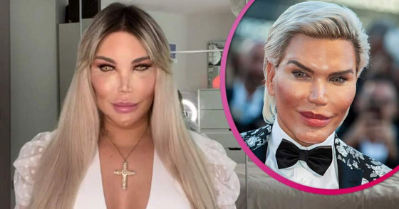 صور : تحول لنوع ثاننو90 عملية تجميل.. مليون إسترليني في سبيل 