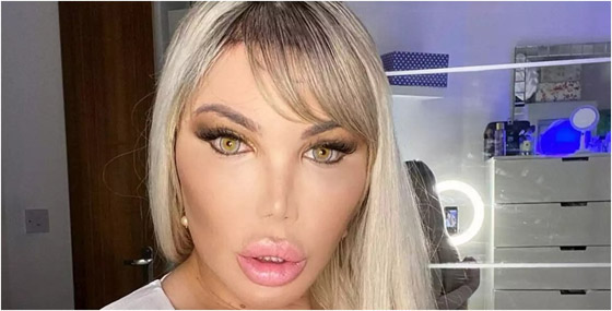 صور : تحول لنوع ثاننو90 عملية تجميل.. مليون إسترليني في سبيل 