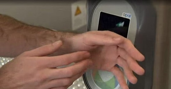 أغرب حالات لأشخاص زرعوا أجهزة إلكترونية في أجسامهم صورة رقم 4