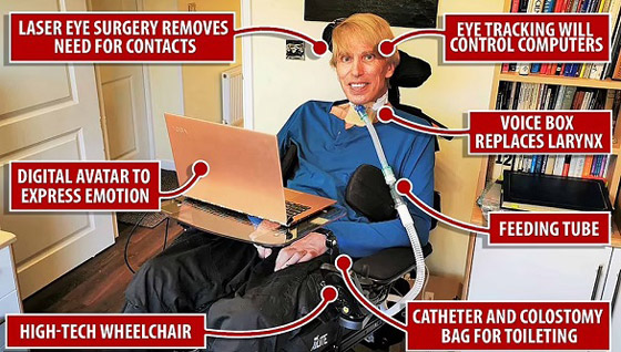 أغرب حالات لأشخاص زرعوا أجهزة إلكترونية في أجسامهم صورة رقم 5