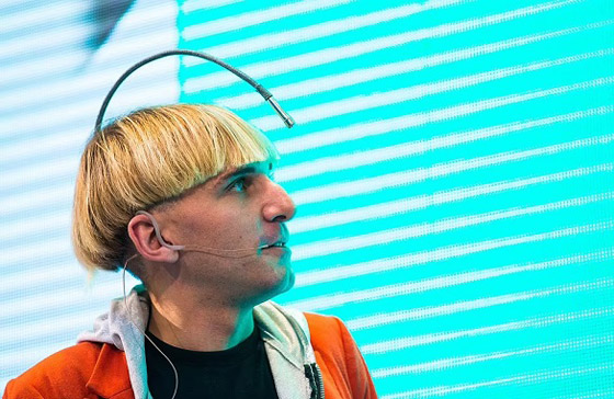 أغرب حالات لأشخاص زرعوا أجهزة إلكترونية في أجسامهم صورة رقم 3