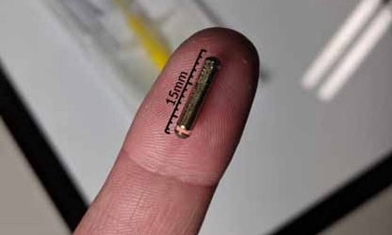 أغرب حالات لأشخاص زرعوا أجهزة إلكترونية في أجسامهم صورة رقم 7