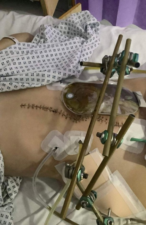 تنجو بأعجوبة بعدما كادت تُقطع من المنتصف صورة رقم 2