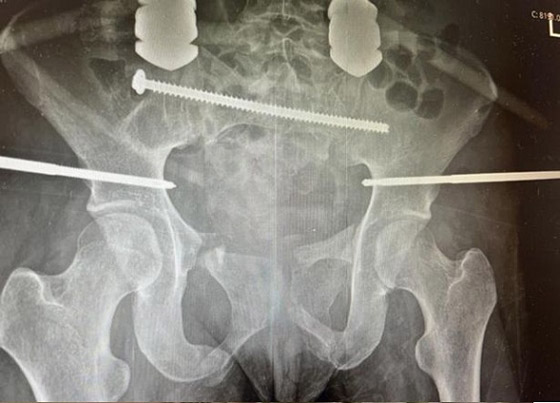 تنجو بأعجوبة بعدما كادت تُقطع من المنتصف صورة رقم 3