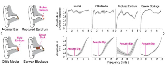 سماعات ذكية تساعد على تشخيص 3 حالات شائعة للأذن صورة رقم 4