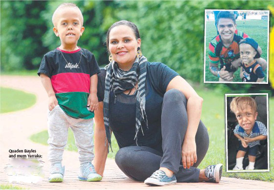 الطفل الأسترالي ضحية التنمر يقتحم عالم السينما صورة رقم 13