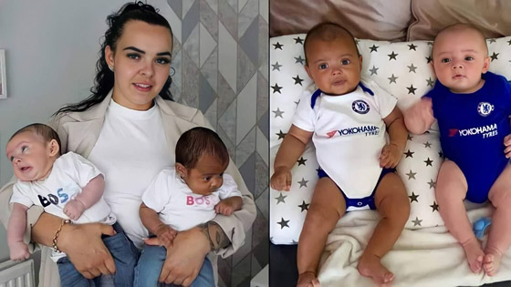 في حالة من مليون.. توأم بريطاني بلوني بشرتين مختلفين تماما صورة رقم 1