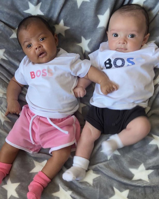 في حالة من مليون.. توأم بريطاني بلوني بشرتين مختلفين تماما صورة رقم 2