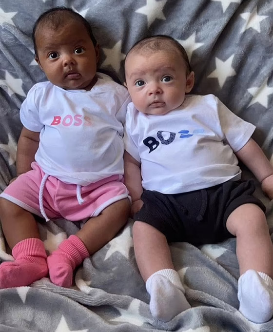 في حالة من مليون.. توأم بريطاني بلوني بشرتين مختلفين تماما صورة رقم 4