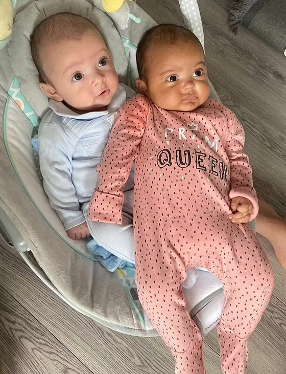 في حالة من مليون.. توأم بريطاني بلوني بشرتين مختلفين تماما صورة رقم 5