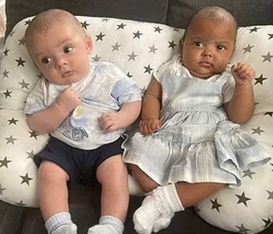 في حالة من مليون.. توأم بريطاني بلوني بشرتين مختلفين تماما صورة رقم 7