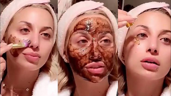 ماسك القرفة والعسل أضراره وفوائده وكيفية استخدامه صورة رقم 2
