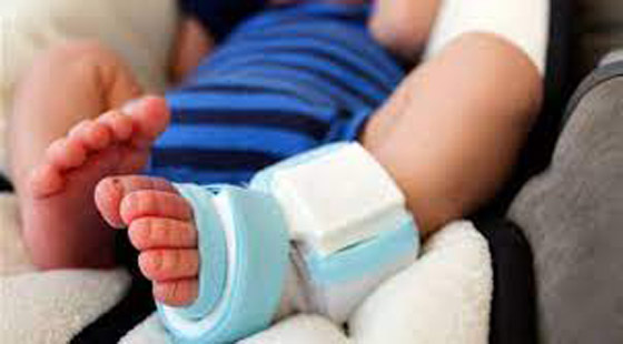 جورب ذكي لتتبع نوم الطفل وضربات قلبه صورة رقم 5