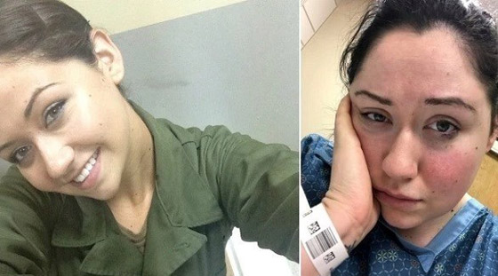 تعاني من حساسية تجاه الجاذبية تجعلها محبوسة في السرير صورة رقم 1