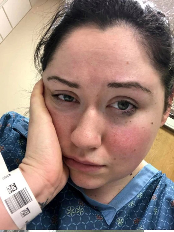 تعاني من حساسية تجاه الجاذبية تجعلها محبوسة في السرير صورة رقم 2