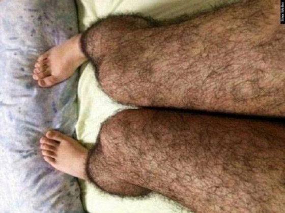 أغرب الأشياء بالعالم: أم بالغة من العُمر 5 سنوات ودجاجة تعيش دون رأس صورة رقم 4