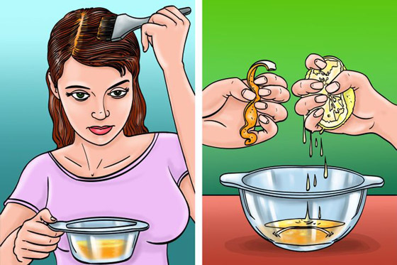 اليكم افضل 5 وصفات لمكافحة قشرة الرأس صورة رقم 2