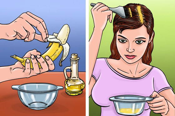 اليكم افضل 5 وصفات لمكافحة قشرة الرأس صورة رقم 4