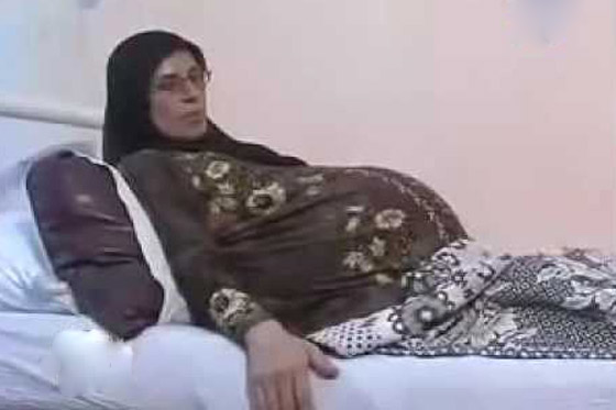 غزالة.. قصة أم مصرية تفاجئ الأطباء وتنجب 7 توائم صورة رقم 3