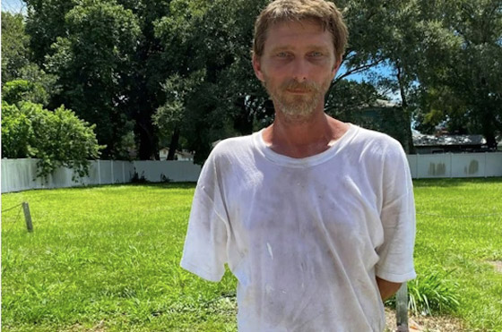 يظل حياً 3 أيام في الغابة بعد أن التهم تمساح ذراعه صورة رقم 2