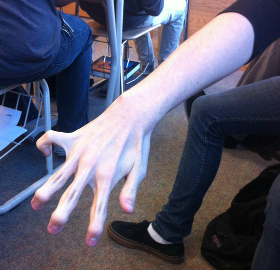 أشخاص لديهم سمات جسديّة أندر من الأمطار في الصحارى صورة رقم 3