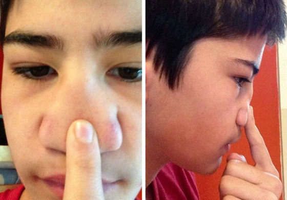 أشخاص لديهم سمات جسديّة أندر من الأمطار في الصحارى صورة رقم 2