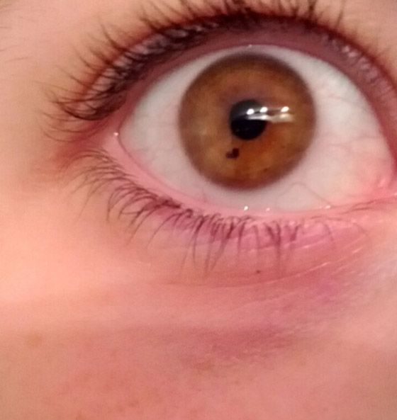 أشخاص لديهم سمات جسديّة أندر من الأمطار في الصحارى صورة رقم 1