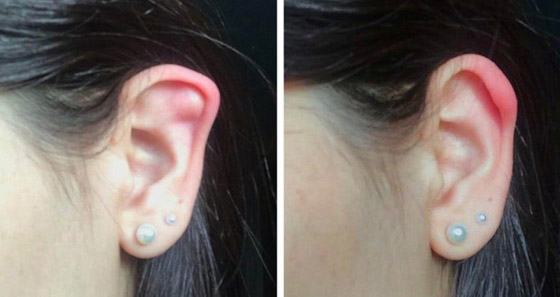 أشخاص لديهم سمات جسديّة أندر من الأمطار في الصحارى صورة رقم 4