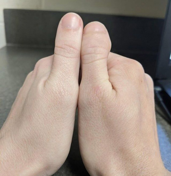 أشخاص لديهم سمات جسديّة أندر من الأمطار في الصحارى صورة رقم 5