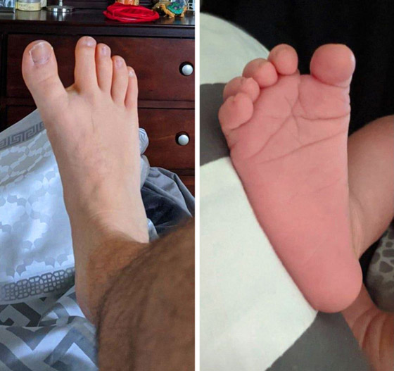 أشخاص لديهم سمات جسديّة أندر من الأمطار في الصحارى صورة رقم 8