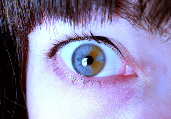 أشخاص لديهم سمات جسديّة أندر من الأمطار في الصحارى صورة رقم 10