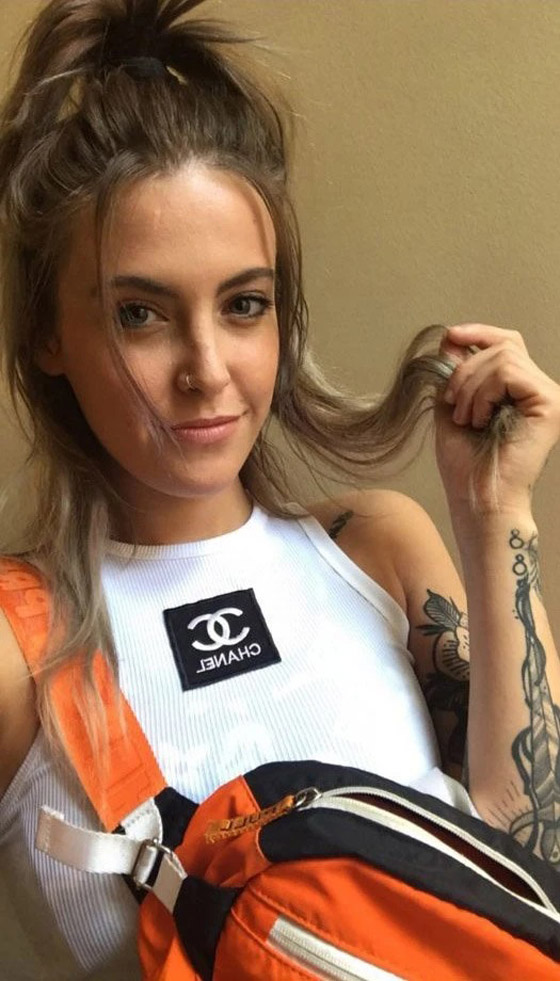 تمتنع عن مغادرة المنزل بسبب كريم للأكزيما ! صورة رقم 3