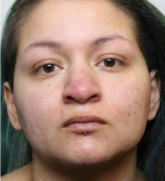 يجبران طفلتهما على الجلوس في حمام بارد لثلاث ساعات .. والنتيجة كارثية؟ صورة رقم 2