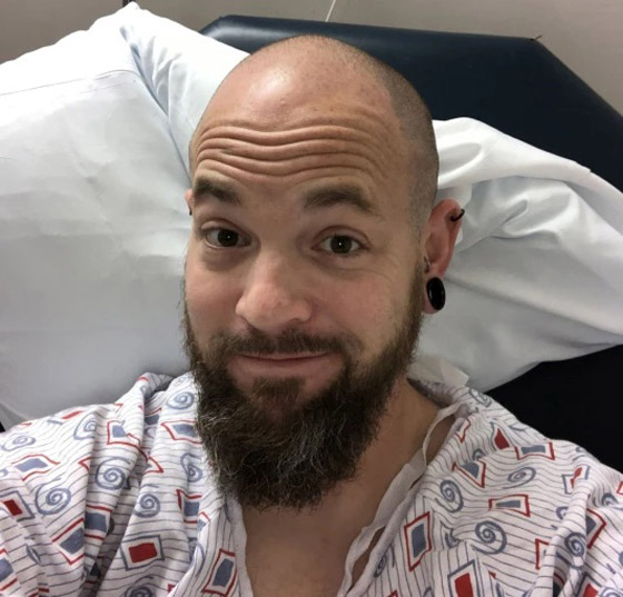 يعثر على حلقة أنف فقدها من 5 سنوات في رئته صورة رقم 2