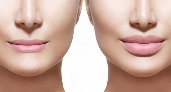 لشفاه ممتلئة.. 4 حيل بعيدا عن عمليات التجميل صورة رقم 8