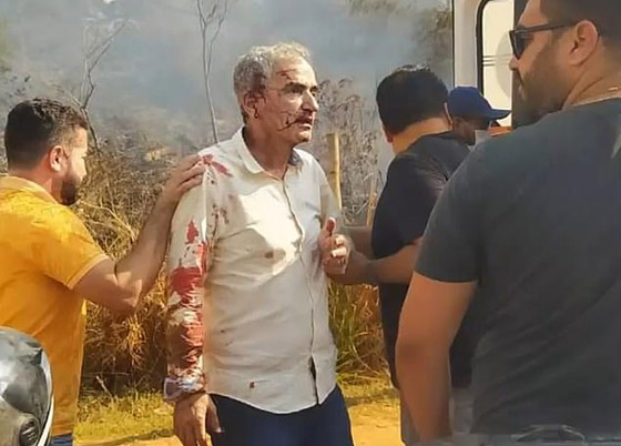 فيديو: طائرة تصطدم بأسلاك الكهرباء وتتحطم ومفاجأة بعد ذلك! صورة رقم 5 فيديو: طائرة تصطدم بأسلاك الكهرباء وتتحطم ومفاجأة بعد ذلك! صورة رقم 5
