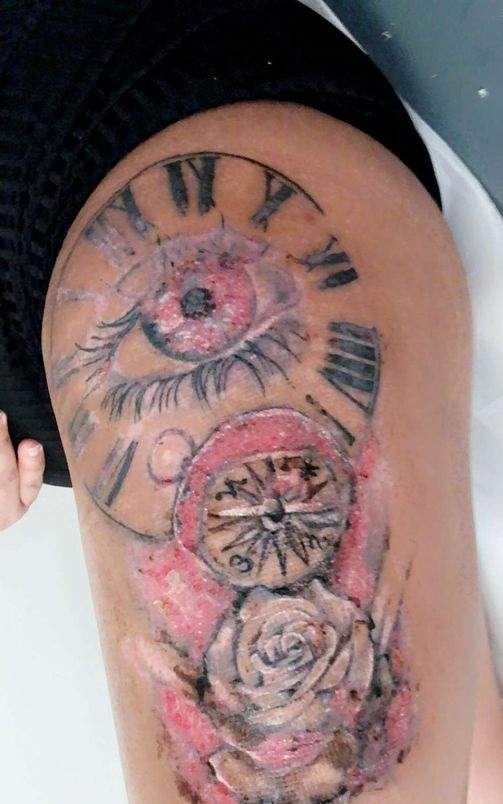  ! تكاد تفقد ساقها بسبب وشم صورة رقم 3