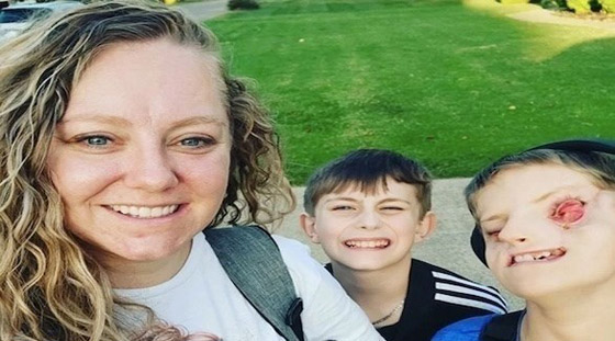 تشارك قصة طفلها الذي ولد بلا عينين .. والسبب؟ صورة رقم 1