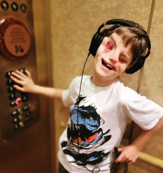 تشارك قصة طفلها الذي ولد بلا عينين .. والسبب؟ صورة رقم 3